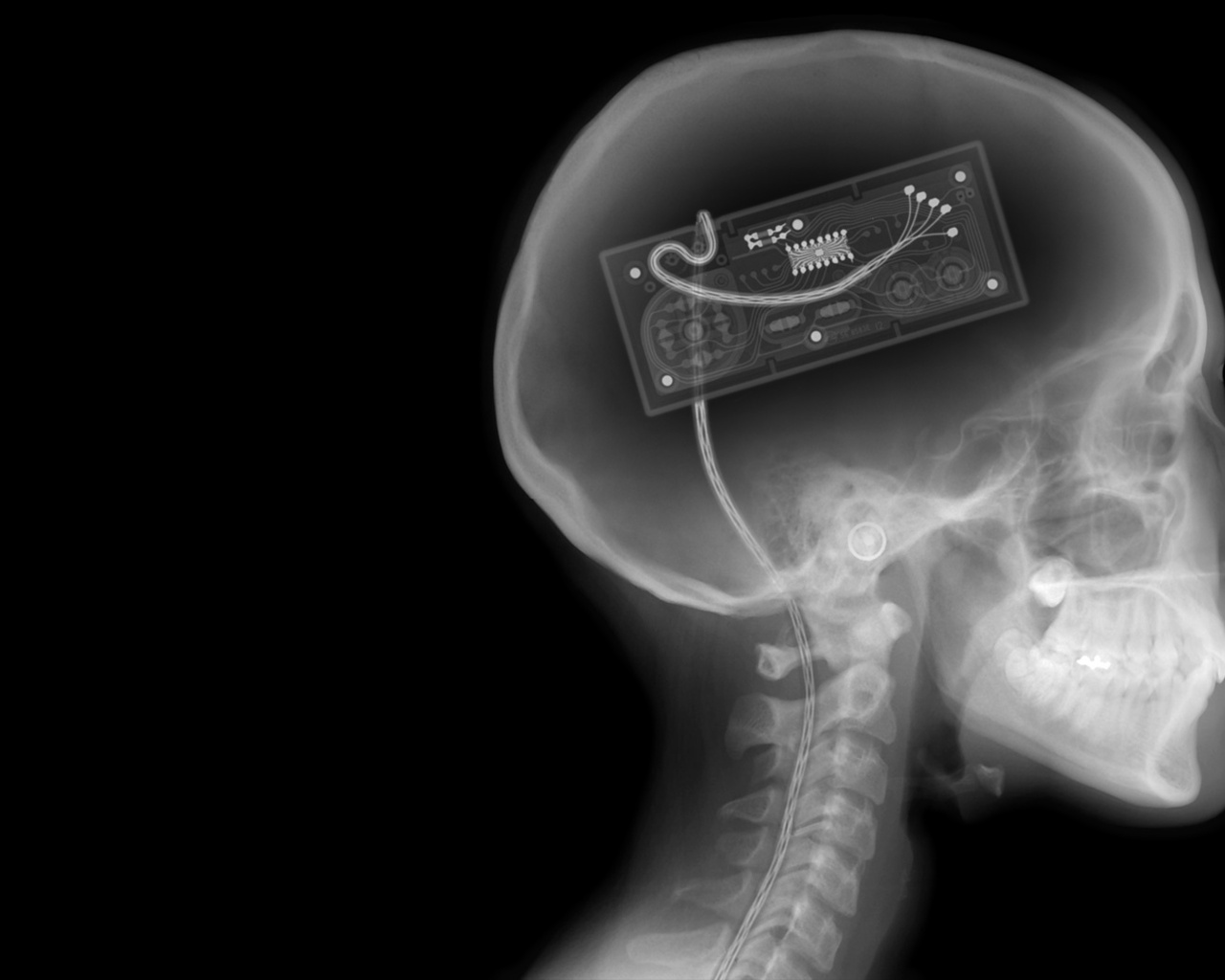 голова, череп рентген, текстура, фон, скачать фото, head skull x-ray texture background