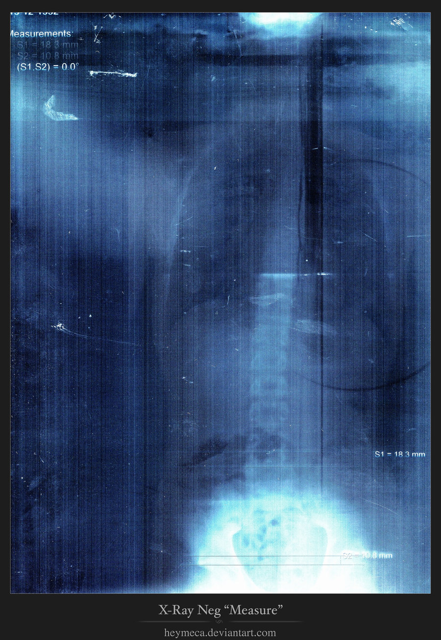 рентген, текстура, фон, скачать фото, x-ray texture background