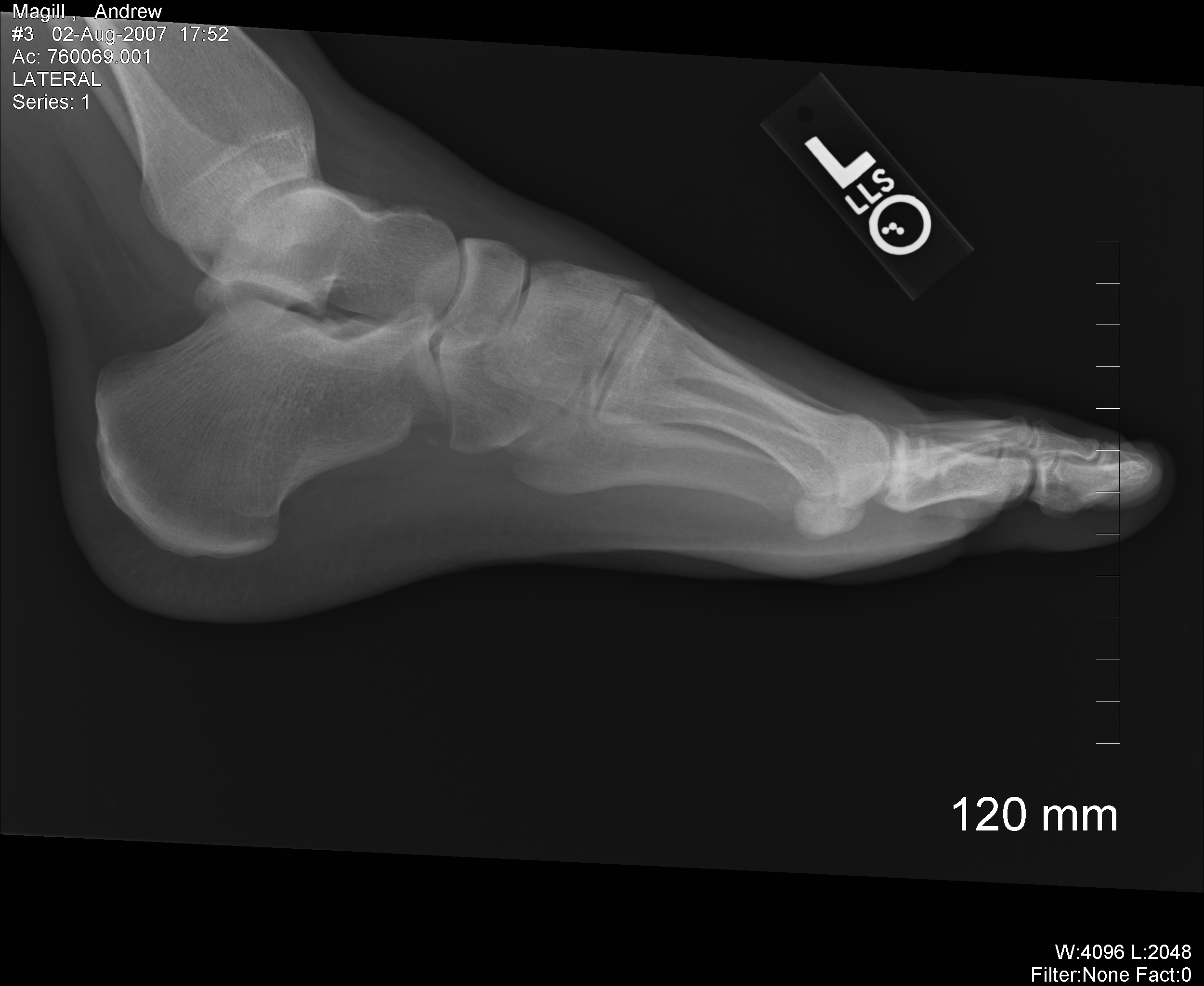 рентген ноги, текстура, фон, скачать фото, foot x-ray texture background